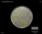 E.coli on cled